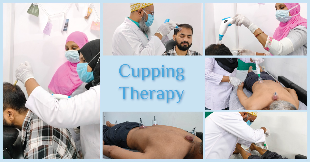 Rejuvenating cupping therapy near me for deep relaxation at My Shifakhana